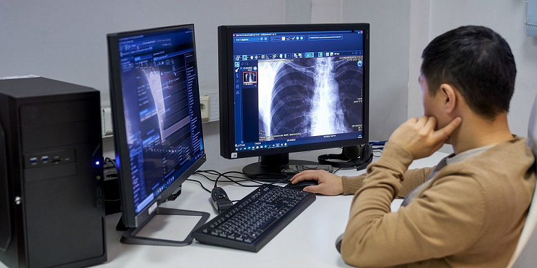 В поликлиниках Москвы внедрят анализ рентгеновских снимков без участия врача — уже с мая